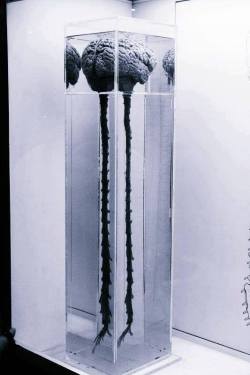 sixpenceee:Brain and spinal cord.