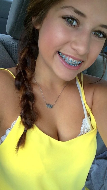 Having braces at 18 years old would be tough&hellip; or so she thought! So many nice men complim