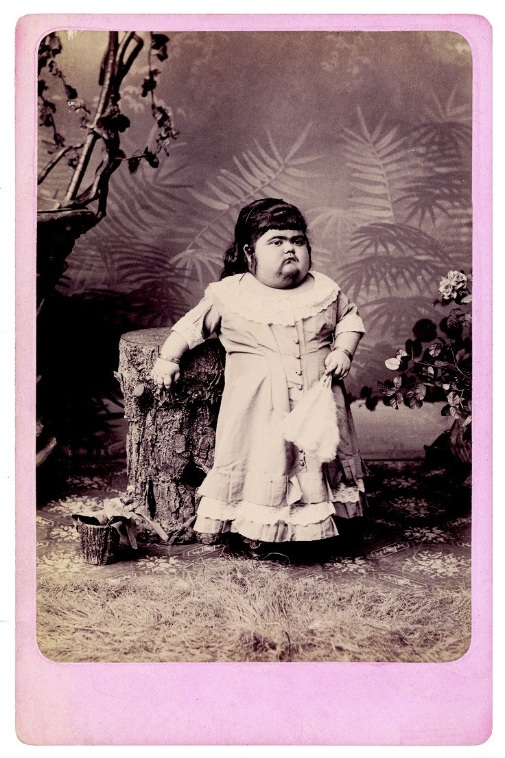carnytrash:  resonanceinthehalls:  Vintage Photography of Circus ‘freaks’ and