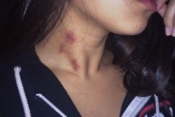 hickey-aesthetic:from @unfigured-out