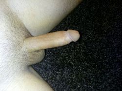 baredbellend:  a cock submitted for approvalgerman, of course. doctor cut him up as a boy because his foreskin was all tight and fucked up. now his whole cock is tight and fucked up. many such cases!  Fucked up but perfect
