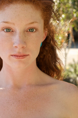 Redhead Freckled