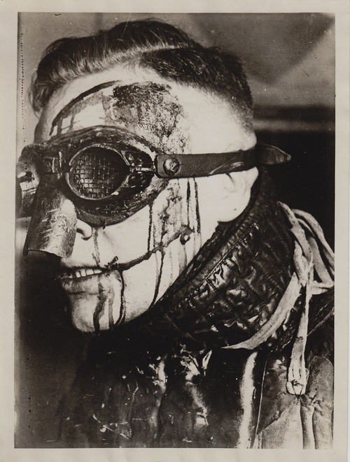 demented-diary:  German student with dueling scars. Also called “bragging scars,”
