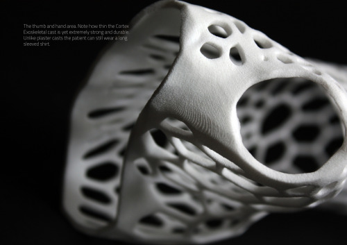 sagansense:  Cortex: The 3D-Printed Cast After many centuries of splints and cumbersome plaster casts that have been the itchy and smelly bane of millions of children, adults and the aged alike the world over, we at last bring fracture support into the