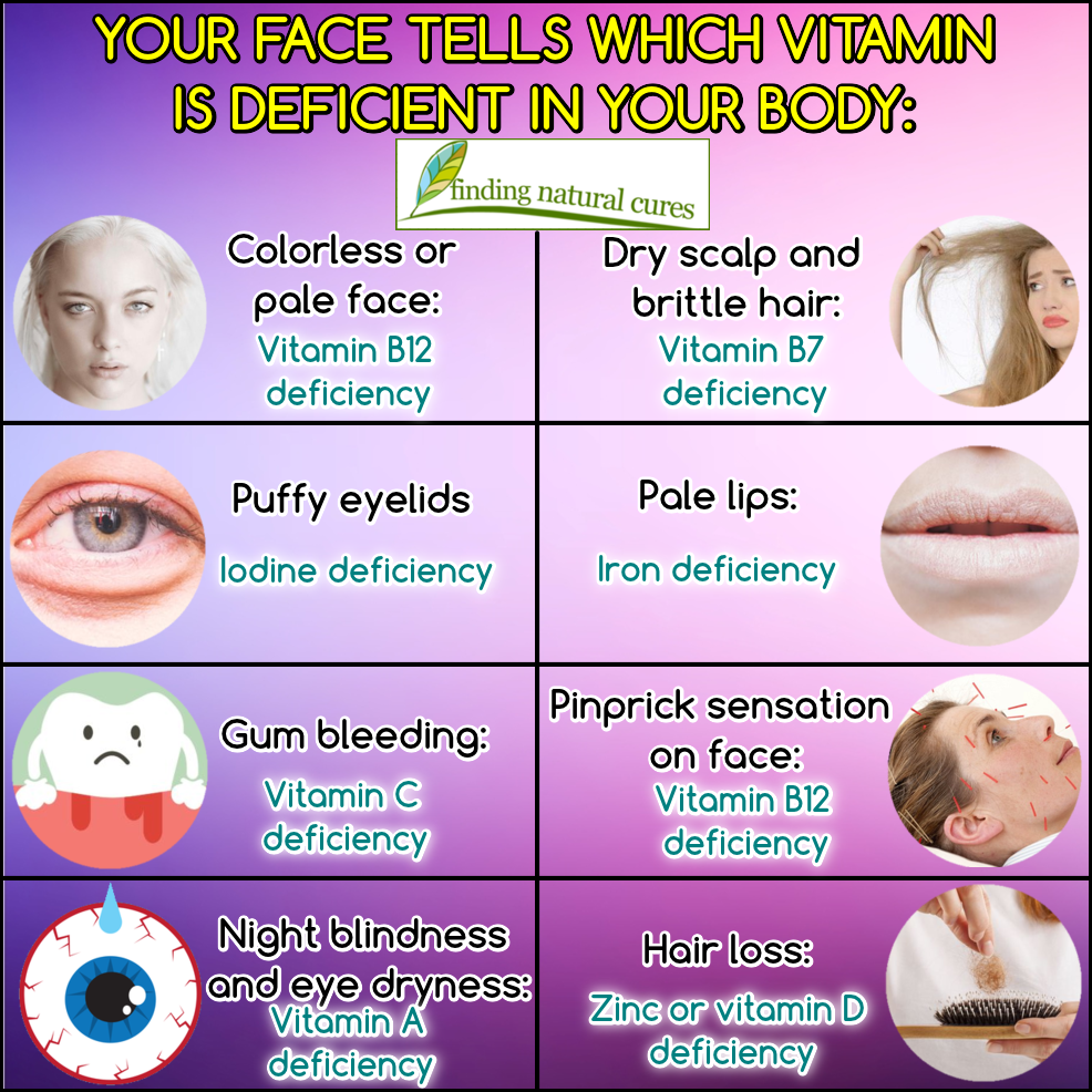 Finding Natural Cures Your Face Tells Which Vitamin Is Deficient In Your