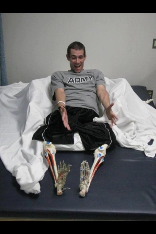 huffpostcomedy:  14 people who lost their limbs but not their sense of humor Photos via Imgur
