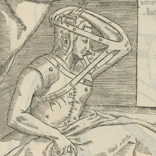houghtonlib:Tagliacozzi, Gaspare, 1545-1599. De curtorum chirurgia per insitionem, 1599.Typ 525.97.8