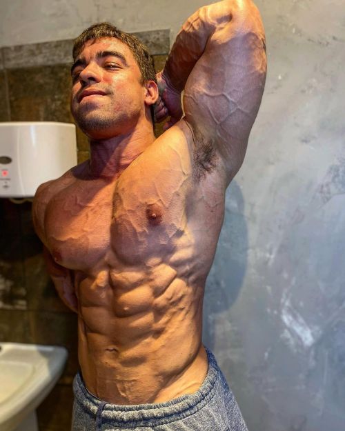 24 yo vascular IG: pedrovalenca6