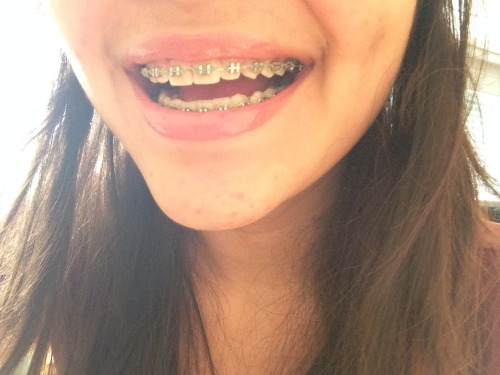 state-of-perks: smile hard