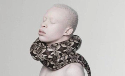 alanspazzaliartist:  Albinos looks so misterious…1.Bera Ivanishvili2. Steven Thompson3.Sanele