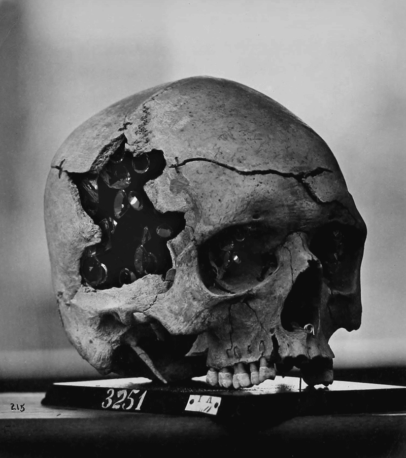 billdomonkos:  GIF: Bill Domonkos, 2016 Image from page 42 of “Photographs of surgical
