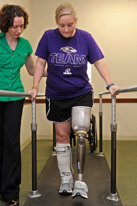Boston Marathon bombing victim gets new leg