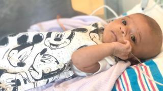 Coronavirus: Newborn with heart defect and virus defies odds