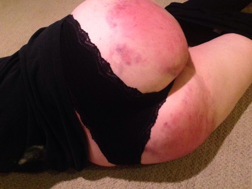 slide1mile6inches:So my butt got beaten pretty well tonight ^_^