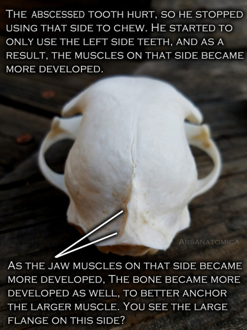 therestlesswitch: formaldehund: arsanatomica: Bones are interesting because you can sometimes read t