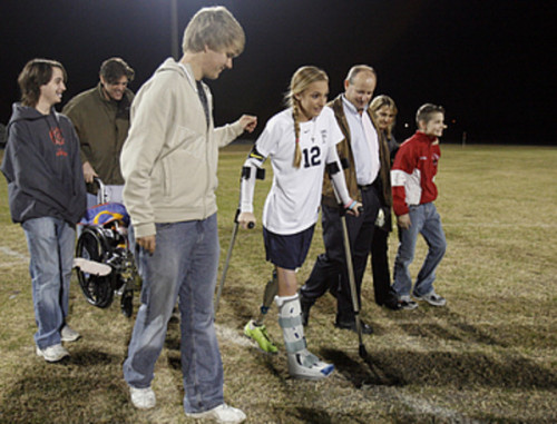 oats-n-whoas:  runningtheremedy:  blondebarbells:  lawgirlrunning:  unusual-passions:  Badly injured at a fundraising car wash. Lost leg but returned to soccer and is now playing at the college level.  BAD. ASS. Tears in my eyes a little. Good reminder