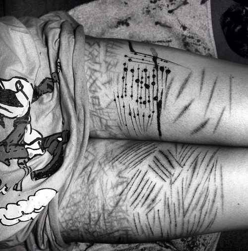 Self Inflicted