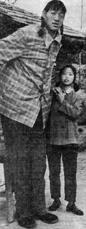 Zeng Jinlian stands with one of her normal-sized friends. She’s only 16, but she’s the tallest girl in the world. Her ultimate height may reach 8 feet.