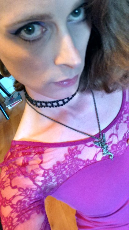 purplesonggirl:  Recovering from an injury, wanted to celebrate!