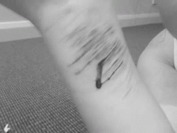 Sobreviver