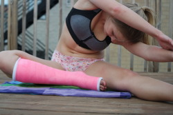 Girl in SLC doing yogaLeg Cast