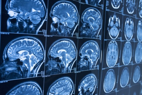 howstuffworks:  Top 10 Scientific Breakthroughs We Couldn’t Live Without When you stop to think about it, humans are pretty amazing animals. Not only have we managed to stick around in various forms for millions of years, but we’ve also grown into