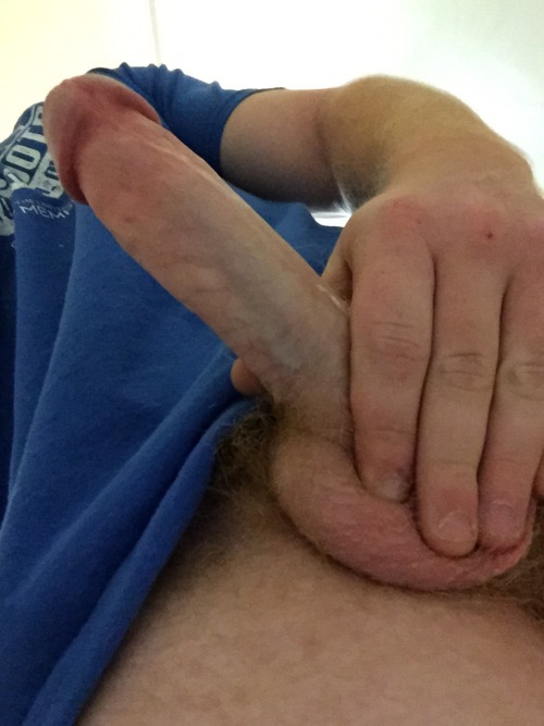 Freckles, Fur & Foreskin