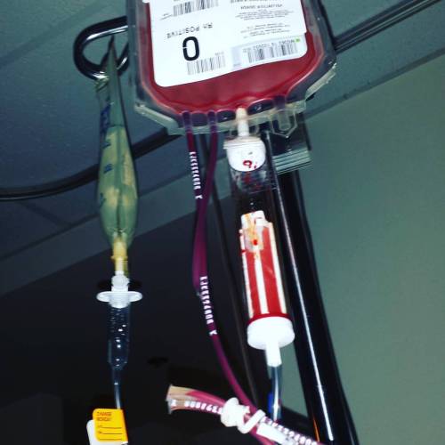 Last night’s blood transfusion. I am a vampire!! Muahhahaha. Count to ten! #mynumbersareup #ul