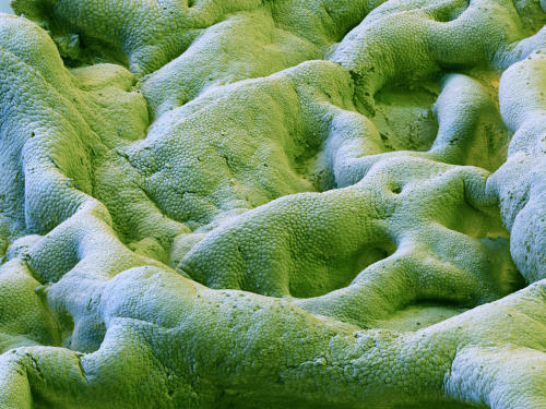 Image SS21025699 (Human Gallbladder SEM)Scanning electron micrograph (SEM) of the surface of the gal