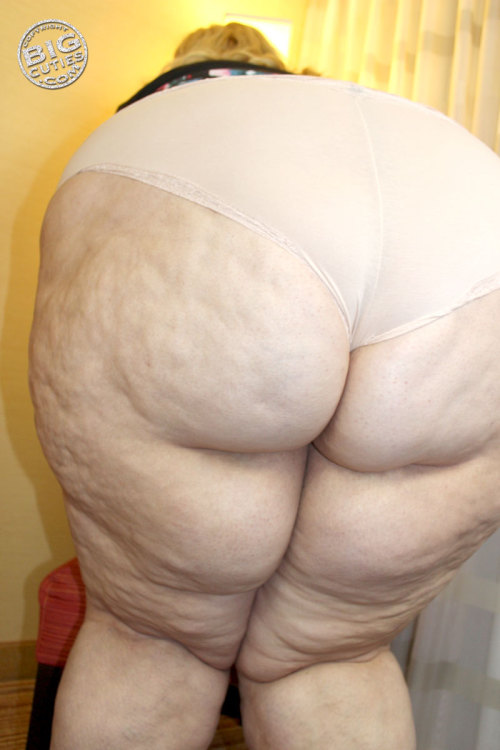 heywewantsomefatty: Cellulite