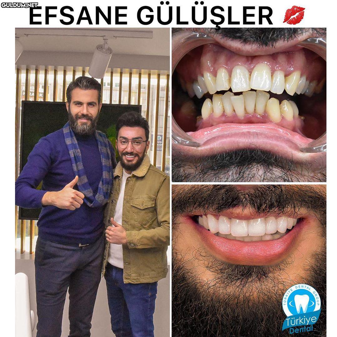 @turkeydental 👈...