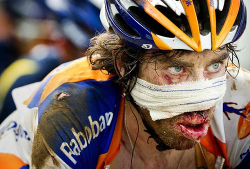 Dutch RaboBank rider Laurens ten Dam is covered with blood after he crashed descending from the Col 