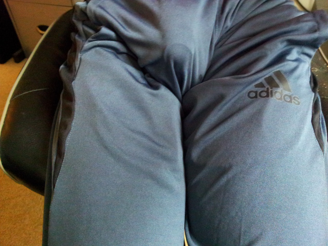 12169003:  foreskin retraction VPL 