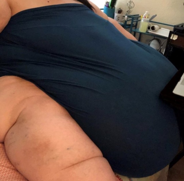 morbidlyobesepig:I’m so morbidly obese the only thing that can cover my huge fat gut is a bed sheet 🥵🐷 lol 