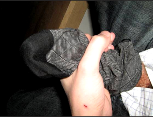 blacksocks2000:  One man one sock! 