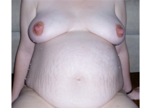 cc1868:  The pregnant belly  adult photos
