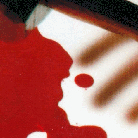 sucking-darkest-clear:  Metallica || Kill’em All || 1983