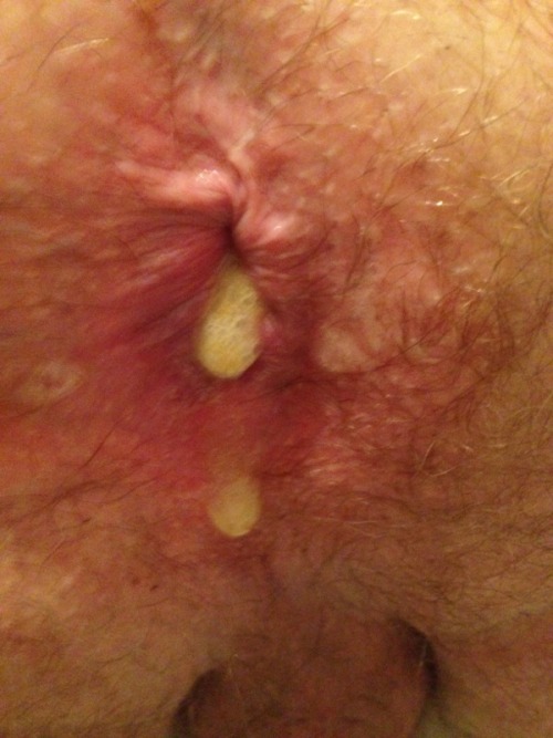 Porn My used fuck hole.  hit me up cmdmp42013@yahoo.com photos