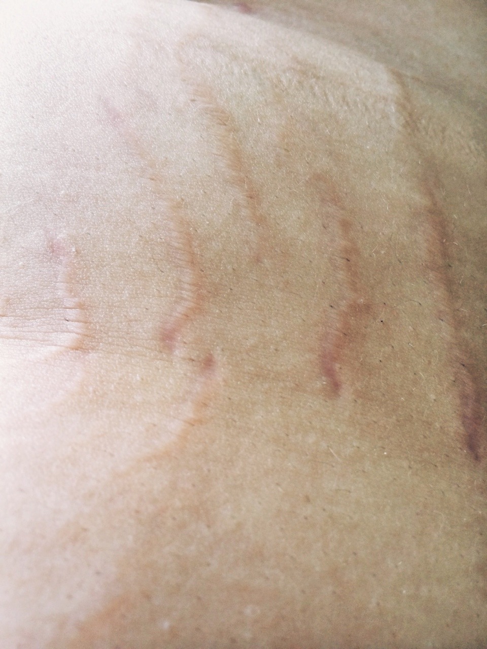 virginsplayground:  These are the parts of myself that I have been taught not to