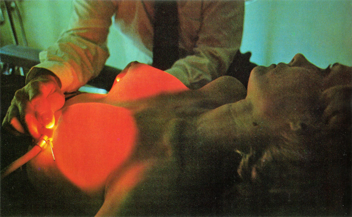 toiletpapercosmos: “He shines two fiber-optic lights through Mrs. X’s newly enlarged