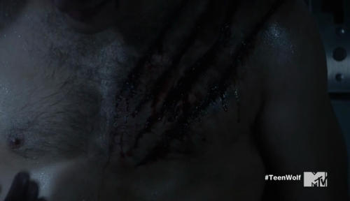 auscap:Dylan Sprayberry - Teen Wolf