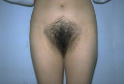 Hairymex