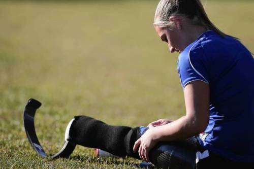oats-n-whoas:  runningtheremedy:  blondebarbells:  lawgirlrunning:  unusual-passions:  Badly injured at a fundraising car wash. Lost leg but returned to soccer and is now playing at the college level.  BAD. ASS. Tears in my eyes a little. Good reminder
