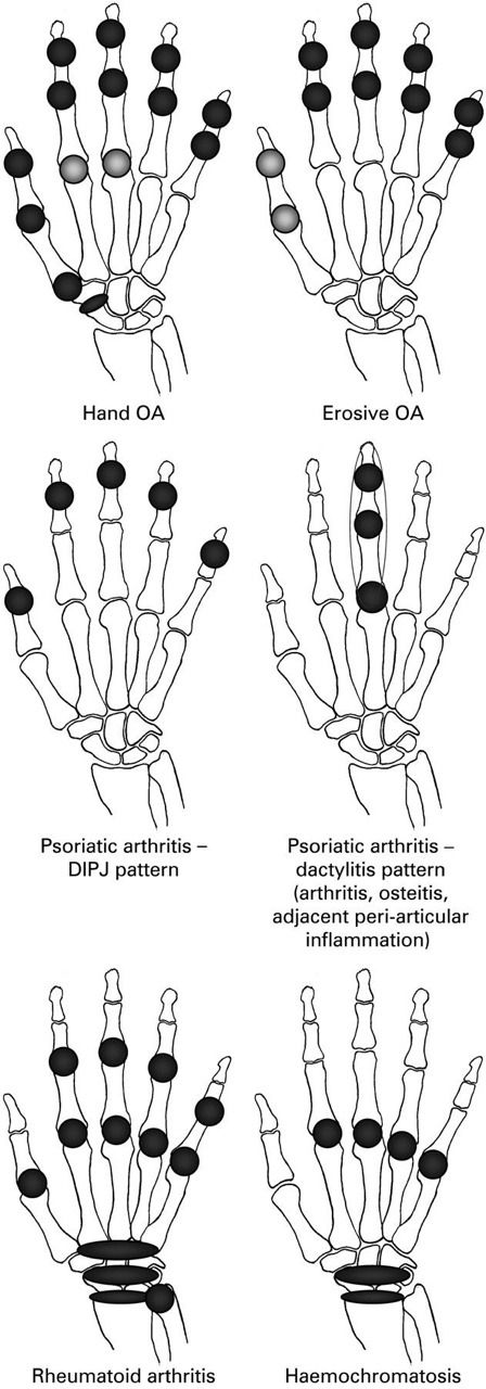uaortho:  Random orthopaedic importanties 
