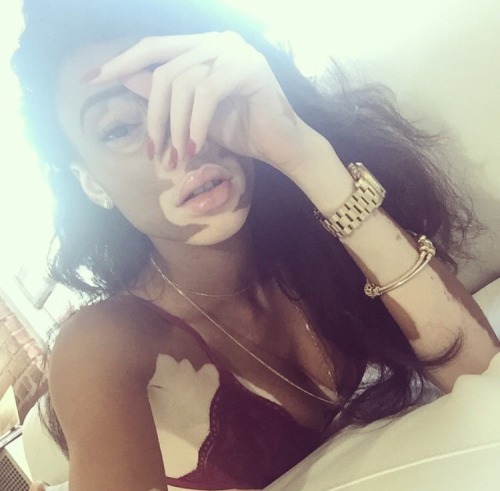 bombshellssonly:  @winnieharlow