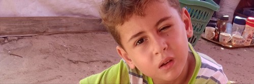 Hello My Friends, I Am Ayman From Gaza. I Have 6 Children And My Young Child Has An Eye Injury And Needs