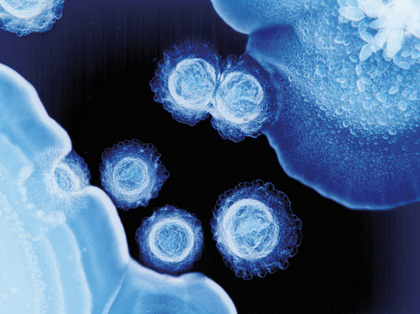 scienceyoucanlove:  This colour-enhanced photomicrograph shows different species of bacteria that cause dental plaque - a colourless film that forms on teeth caused by the growth of bacterial colonies. The sample was removed from the mouth of a patient