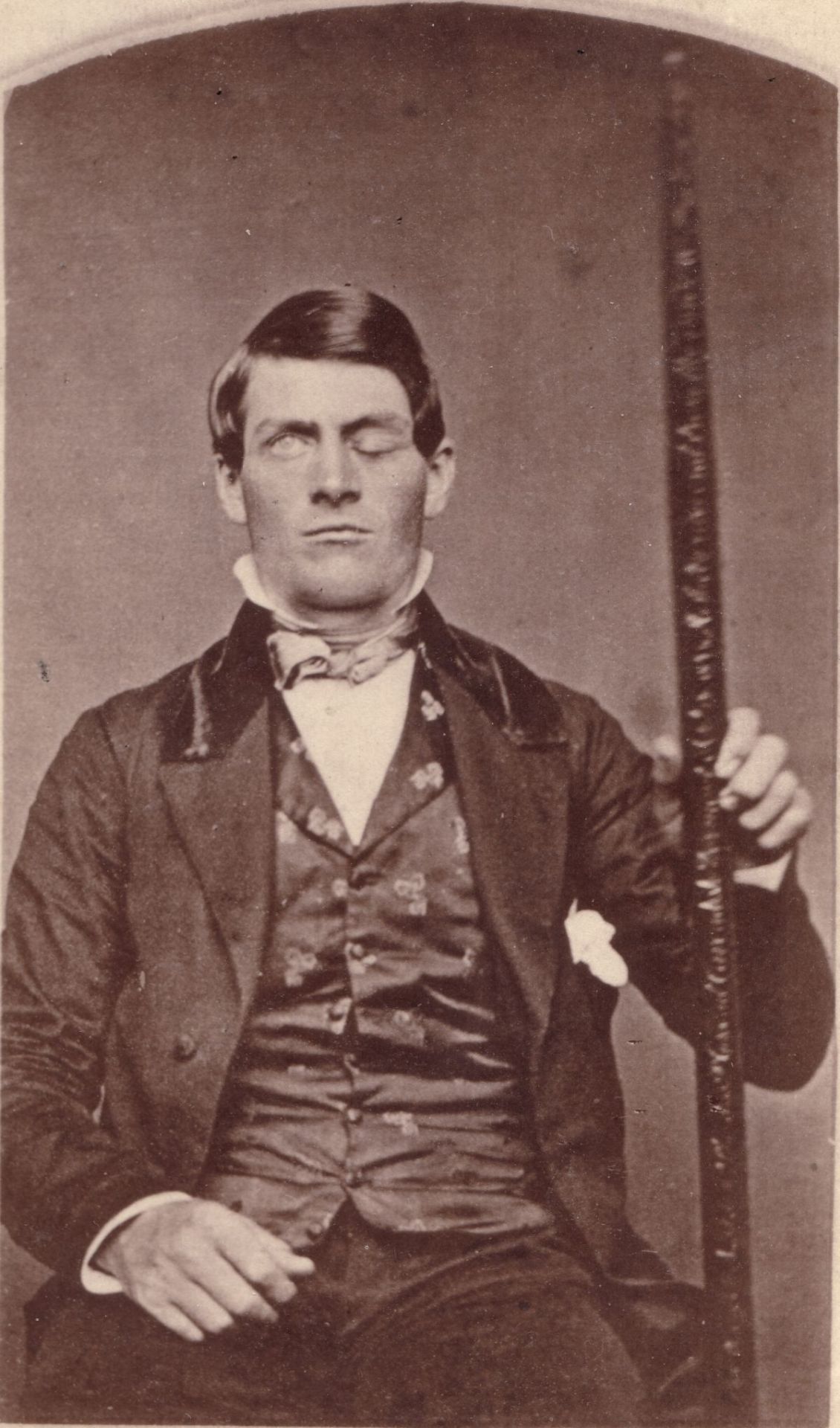 vintageeveryday:  Uncovered after 150 years: Here are two known portraits of Phineas
