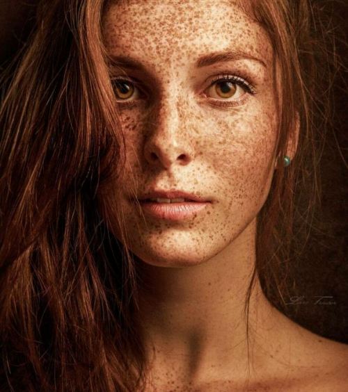 If you are really a freckles lover…