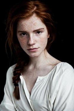 Redhead Freckled